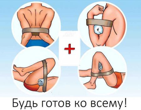 Остановка кровотечений методом максимального сжатия