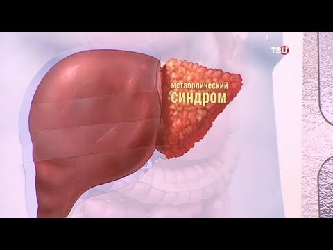 Жировой гепатоз. Доктор И...