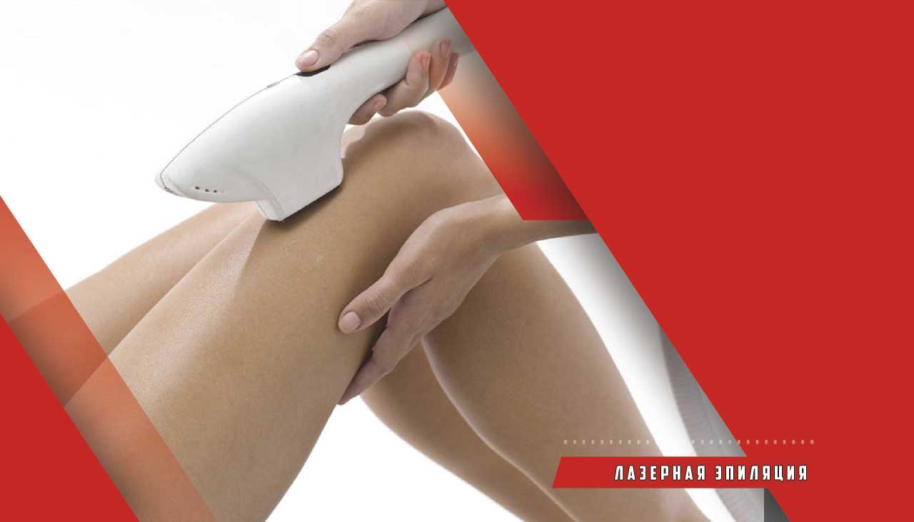 Лазерная эпиляция в Тюмени - удаляет волосы навсегда?